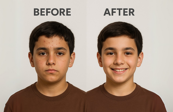 Before & After 3