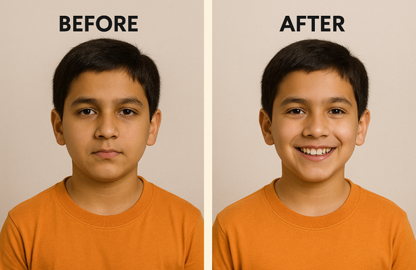 Before & After 1
