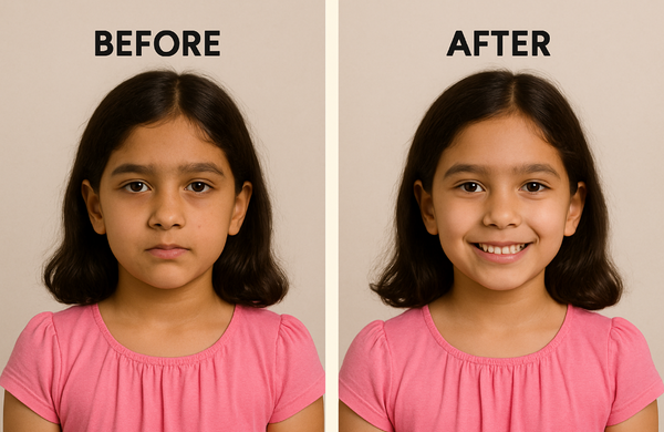 Before & After 2